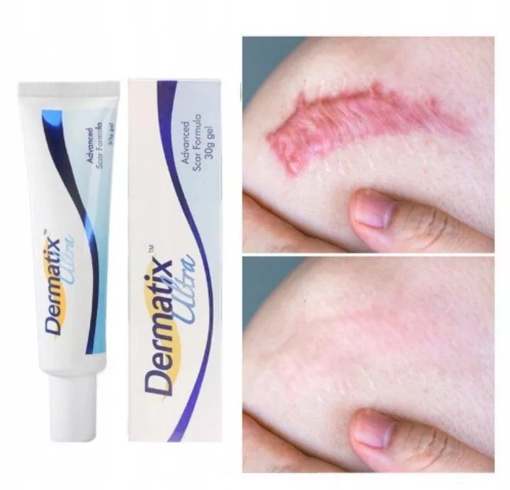 Buy Dermatix Ultra Gel for sale online