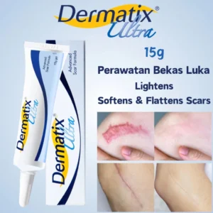 Buy Dermatix Ultra Gel 15g